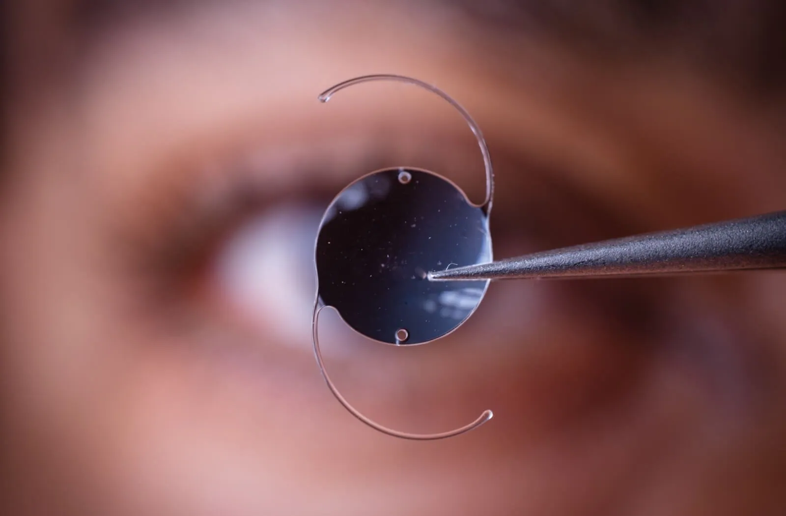 An intraocular lens implant held with surgical forceps
