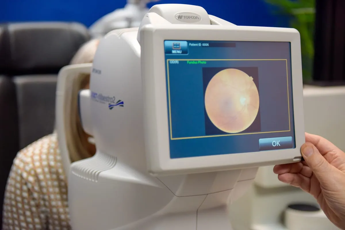 Advanced OCT scanning used to assess the optic nerve at STOTTS.