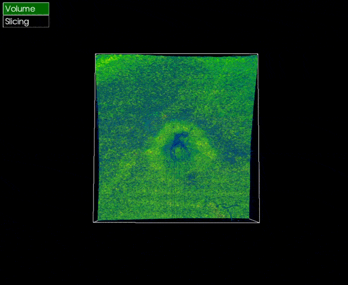 A three-dimensional OCT retinal scan
